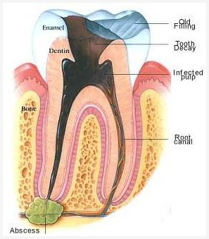 Tooth section